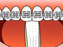Step 4:  Use the tip of your brush for the inner surface of your front teeth.