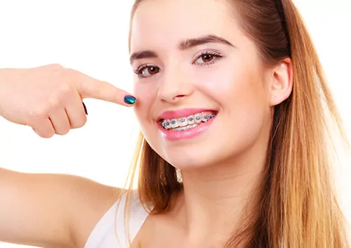 Affordable Braces for Adults Atlanta