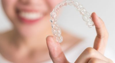 Clear Aligners