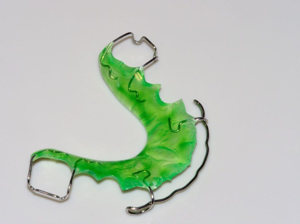 Cleaning Tips for Retainers