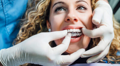 Doctor putting a clear dental aligner on a woman patient